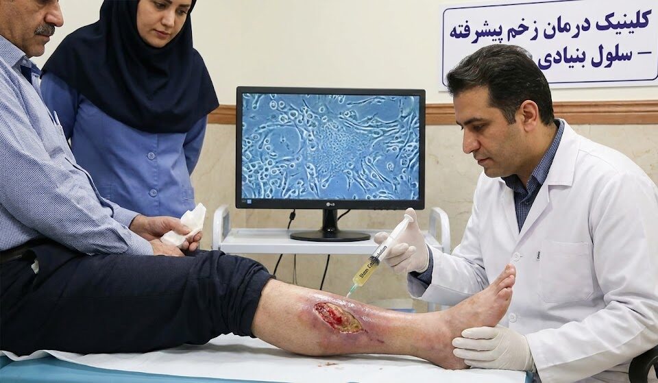 پزشک در حال تزریق محلول سلولهای بنیادی به اطراف زخم مزمن پا به عنوان پیشرفتهترین روش نوین درمان زخم.