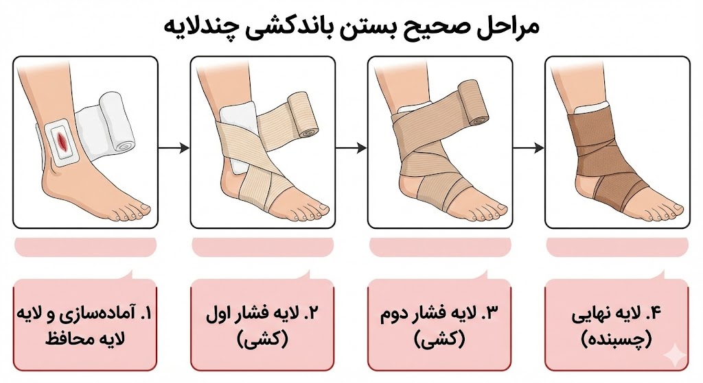 اینفوگرافیک مراحل گام به گام بستن صحیح باندکشی چندلایه برای درمان زخم عروقی و کاهش ادم در کلینیک زخمکده.