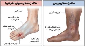 اینفوگرافیک مقایسهای علائم زخمهای عروقی (شریانی) و زخمهای وریدی به زبان فارسی برای تشخیص و درمان.
