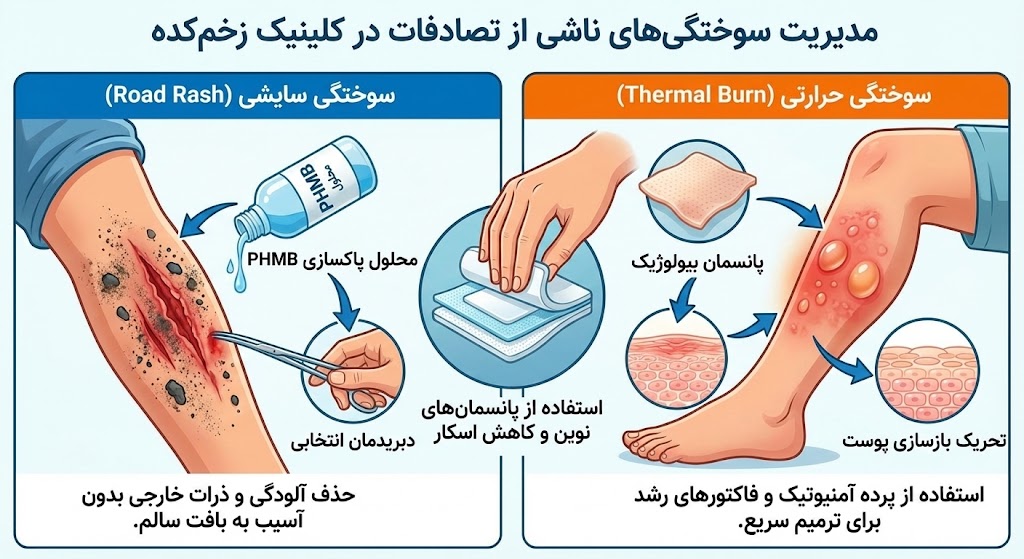 مقایسه روشهای درمان سوختگی سایشی (Road Rash) و سوختگی حرارتی ناشی از تصادف با استفاده از پانسمانهای بیولوژیک در کلینیک درمان زخم حوادث.