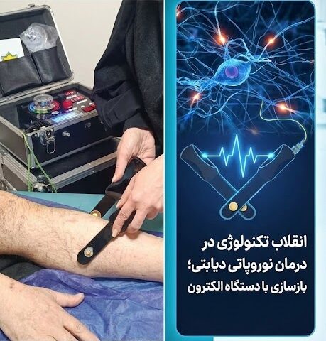 متخصص کلینیک در حال انجام مراحل عملی درمان نوروپاتی دیابتی با استفاده از پروب دستگاه الکترون روی ساق پای بیمار.