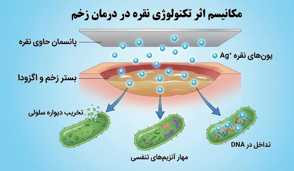 اینفوگرافیک علمی نشان‌دهنده مکانیسم سه‌گانه تکنولوژی نقره در درمان زخم شامل تخریب دیواره سلولی، مهار آنزیم‌های تنفسی و تداخل در DNA باکتری.