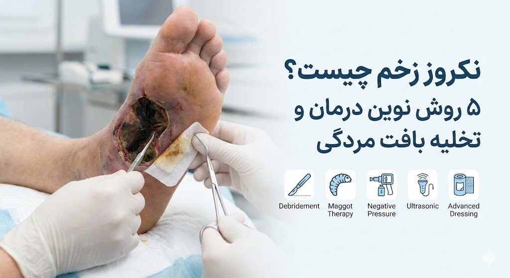 تصویر شاخص مقاله نکروز زخم چیست؟ ۵ روش نوین درمان و تخلیه بافت مردگی، نشان‌دهنده دبریدمان بافت سیاه توسط متخصص زخم.